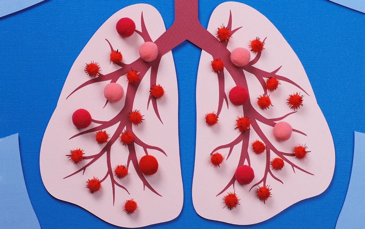 The lowdown on TB
