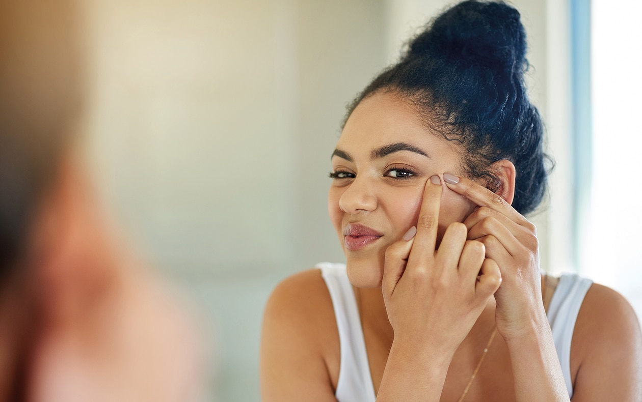Breaking down hormonal acne